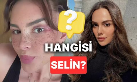 Selin Ciğerci'nin Badem Göz Estetiği Sonrası Değişimi