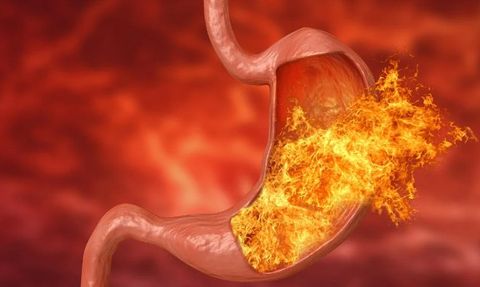 Mide Yanması: Nedenleri ve Doğal Çözüm Yolları