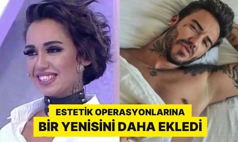 Neslihan Doğrusöz Estetik Operasyonlarına Devam Ediyor