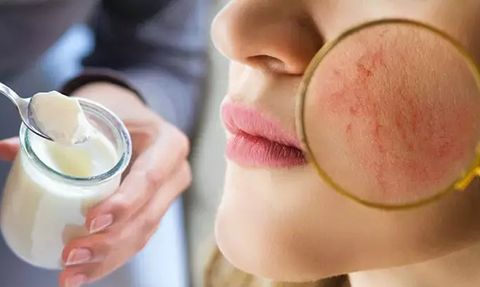 Bağırsak Sağlığı ve Cilt Problemleri Arasındaki İlişki