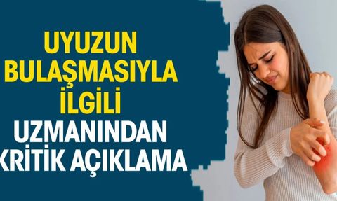 Uyuz Hastalığı ve Uzmanların Açıklamaları