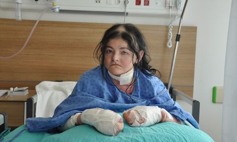 Amerikalı Genç Kız, Eskişehir'de Hayat Değiştiren Ameliyat Geçirdi