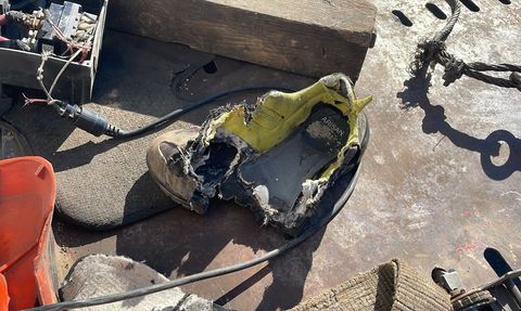 Isparta'da Otomobil Çekimi Sırasında Kaza: Ayak Parmakları Kopan Yaralı Hastaneye Sevk Edildi