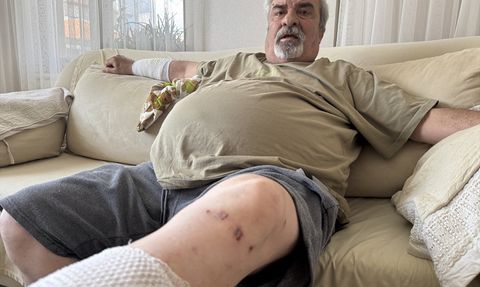 Aksaray'da Köpek Saldırısı Sonrası Yaralanan Vatandaş, Sahipsiz Hayvanların Toplanmasını Talep Ediyor