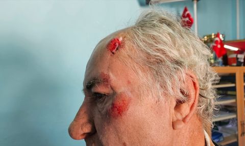 Burdur'da Sahipsiz Köpeklerin Saldırısına Uğrayan Olay