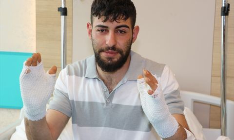 Erzurum'da Otomobilde Hararet Sorunu Yaşayan Teknisyenin Yanık Tedavisi Devam Ediyor