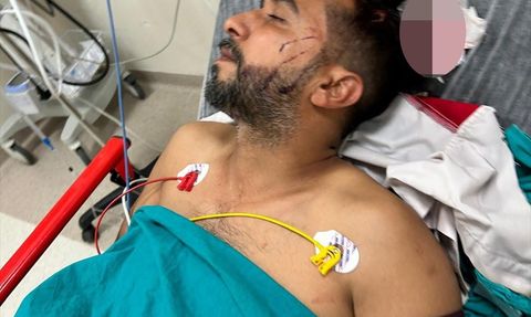 Adana'da Yorgun Mermi ile Yaralanan Döner Ustası