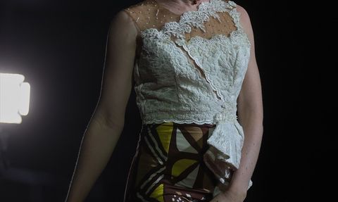 Senegal'de Albinolar İçin Cilt Kanseri Farkındalığı