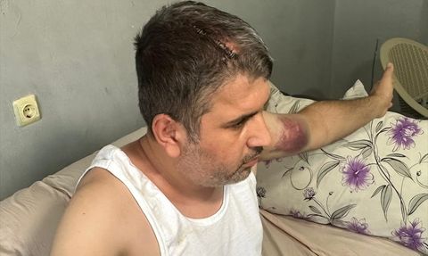 Adana'da Dayı Saldırısında Yaralanma Olayı