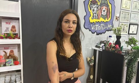 Adana'da Komşularıyla Çatışan Veteriner, Şikayette Bulundu