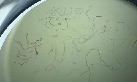 Karadeniz'deki Ticari Balık Türlerinde Mikroplastik Araştırması