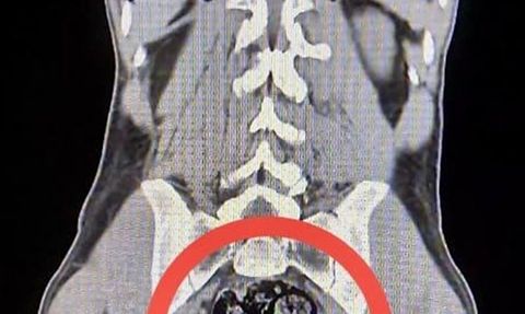 Kars'ta İki İran Uyruklu Uyuşturucu Kuryesi Tutuklandı