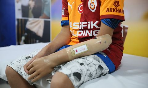 Mehmet Efe'nin Hayali Gerçekleşti: Yeni Proteziyle Oyun Oynadı