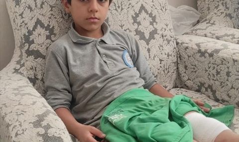 Bursa'da Sahipsiz Köpeğin Saldırısı: Çocuk Yaralandı