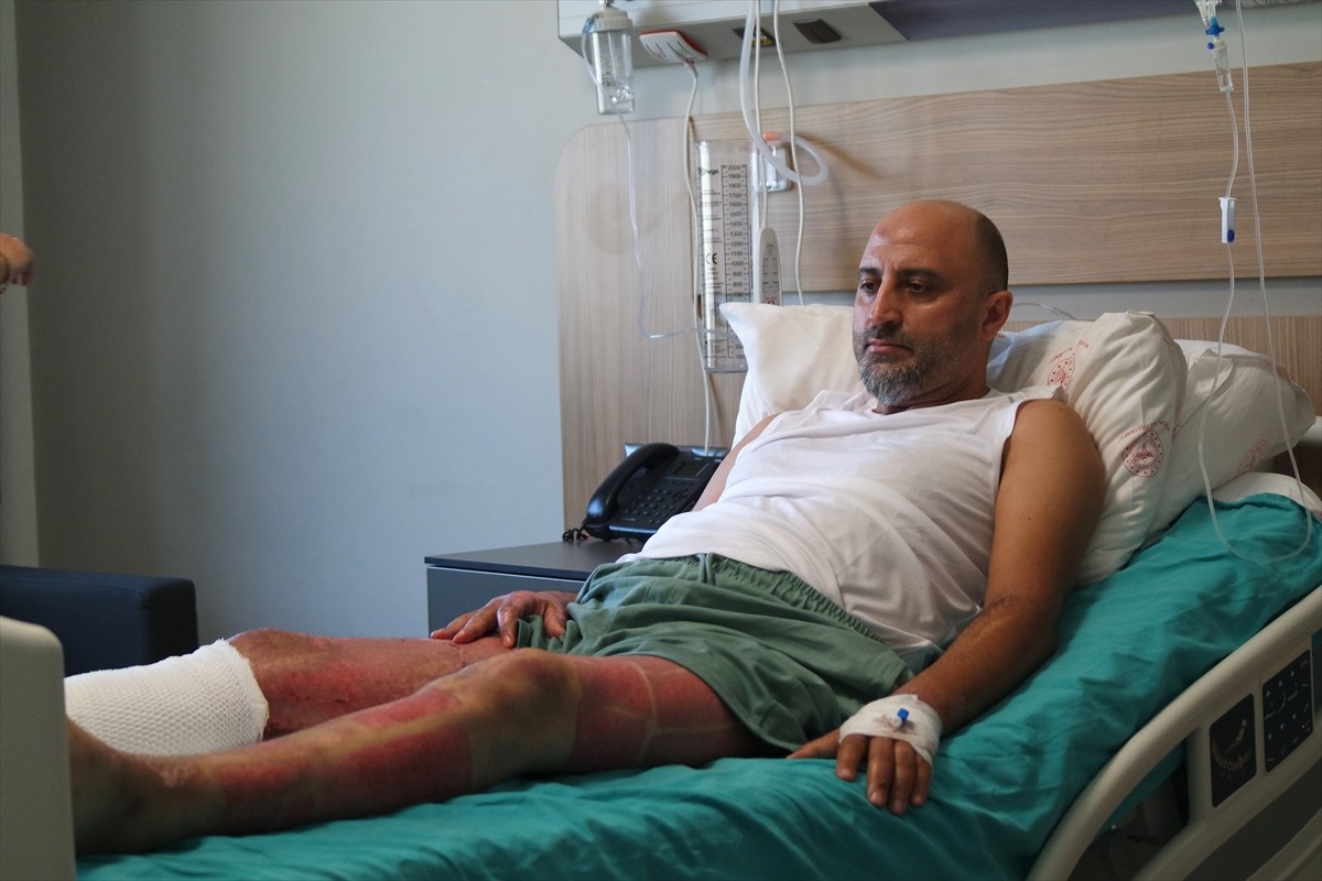 Bursa'da mangal jeliyle semaveri tutuşturmaya çalışan 48 yaşındaki Necdet Özdemir, jelin alev...