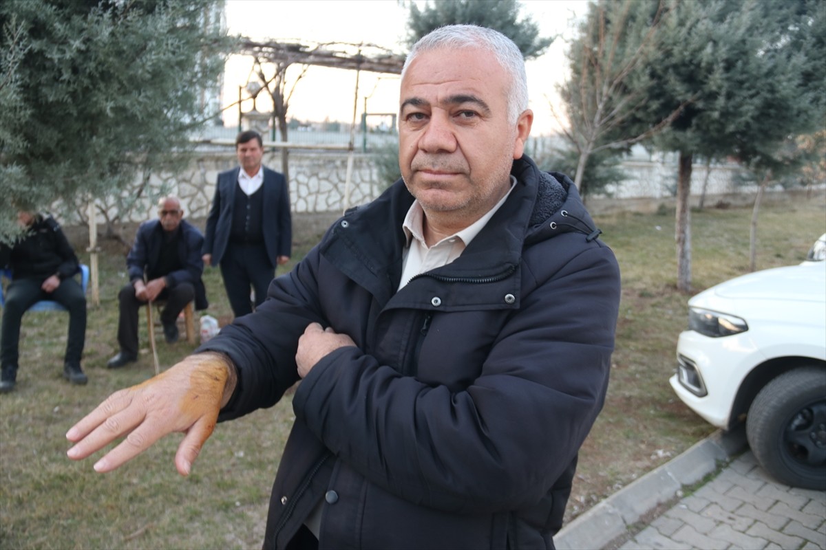 Diyarbakır'da sahipsiz köpeğin saldırısına uğrayan 3 kişi çeşitli yerlerinden yaralandı. Köpeğin...