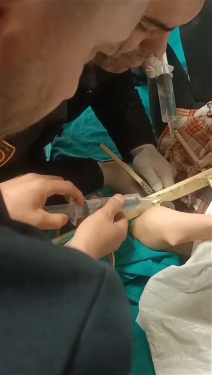 Sivas'ta koluna parmaklık saplanan çocuğu itfaiye ekipleri kurtardı. 8 yaşındaki çocuk, kolundaki...