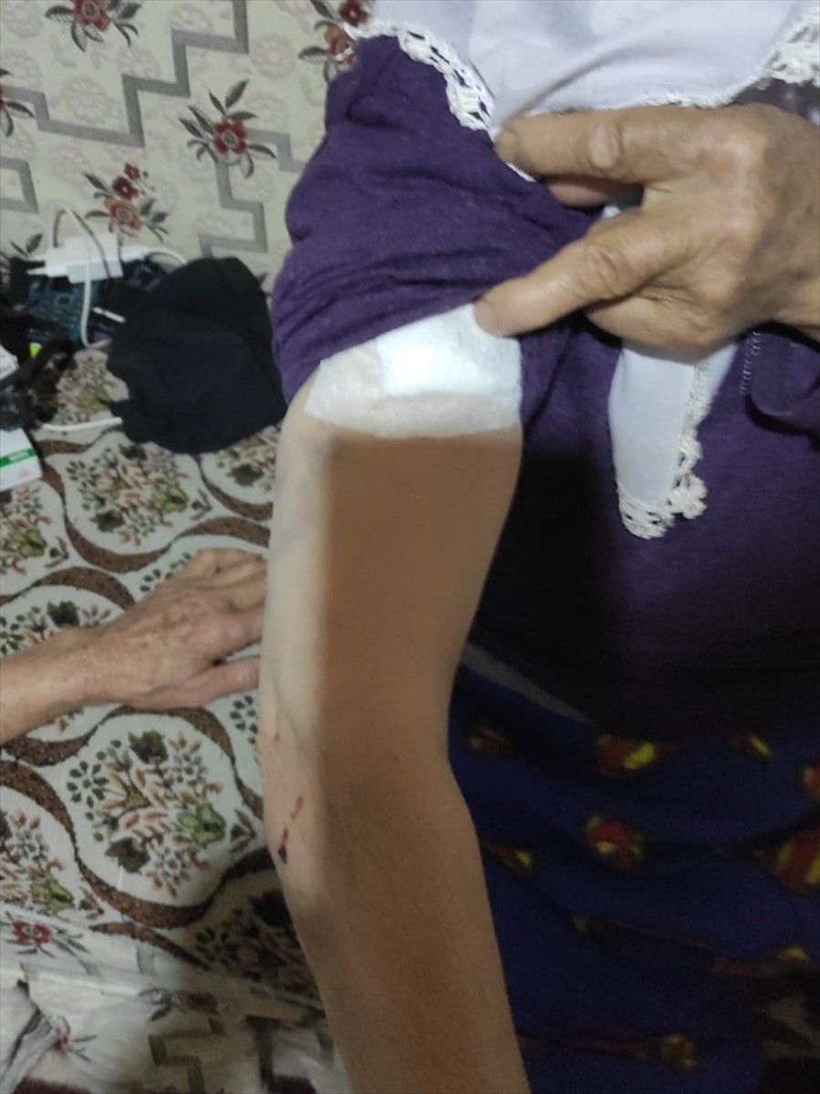 Burdur'un Yeşilova ilçesinde, sahipsiz köpeklerin saldırdığı kadın yaralandı. 