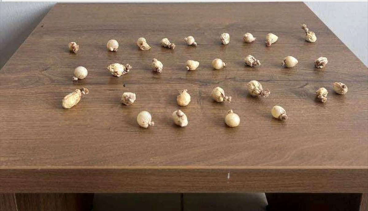 Kocaeli'nin Körfez ilçesinde jandarma ekiplerinin durumundan şüphelendiği kişinin midesinden 28...