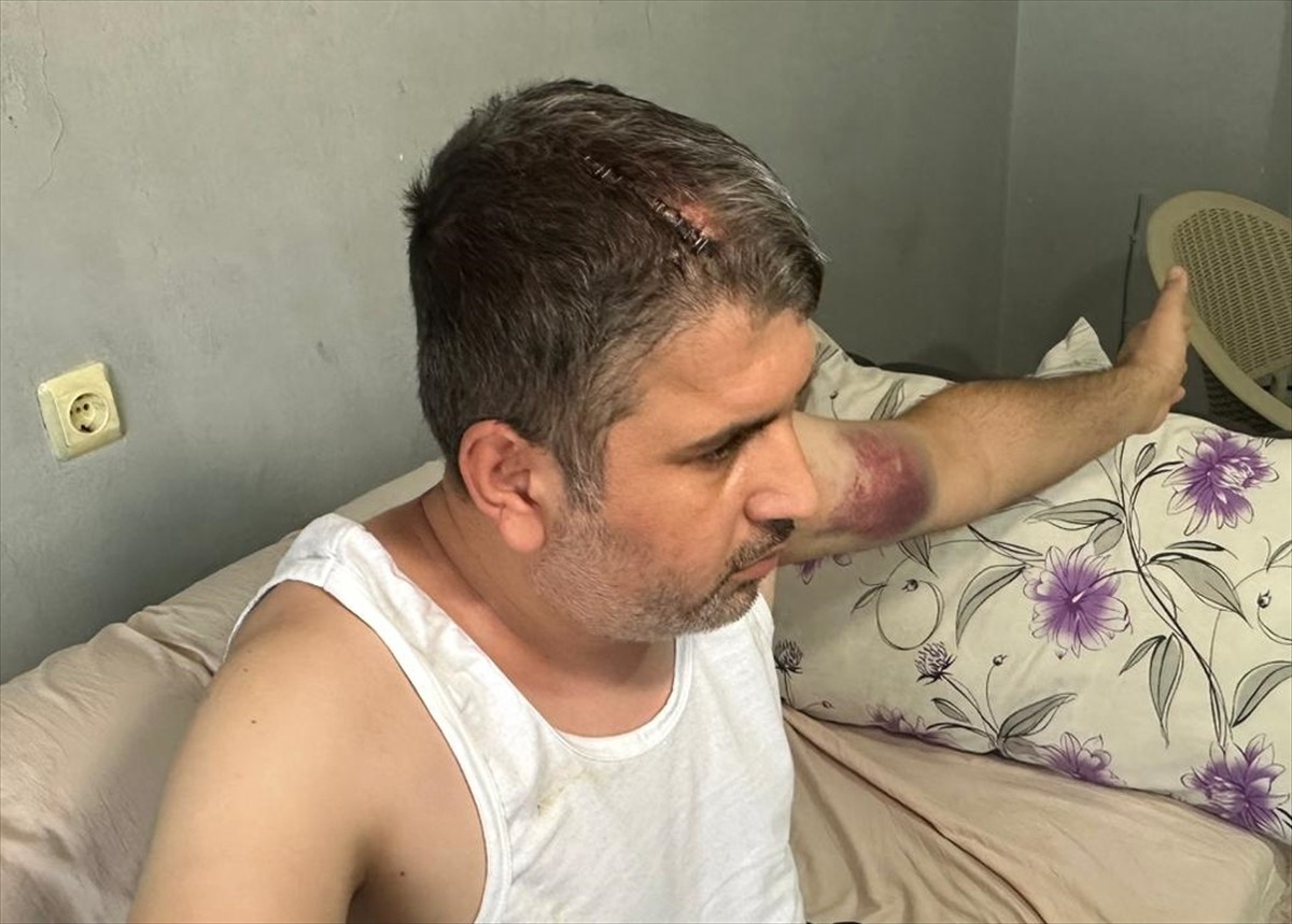 Adana'nın Seyhan ilçesinde, caddede dayısı tarafından beyzbol sopasıyla darbedilen Mehmet A, işi...